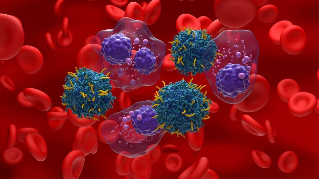 Mieloma múltiple, un cáncer silencioso que avanza sin dar señales claras: "El dolor era impresionante"