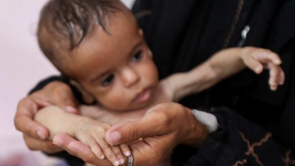 Gaza, niña palestina con inanición, desnutrición.