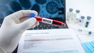 Mpox cobra vida en Quintana Roo: alerta en estos estados