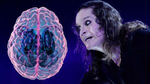 Parkinson, la enfermedad que afectó la salud de Ozzy Osbourne