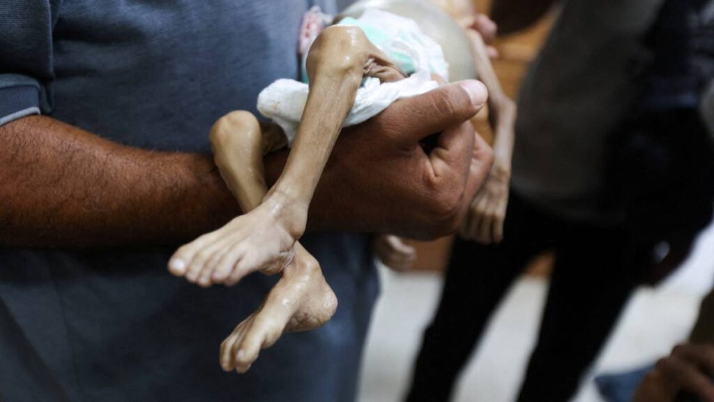 Gaza se muere de hambre