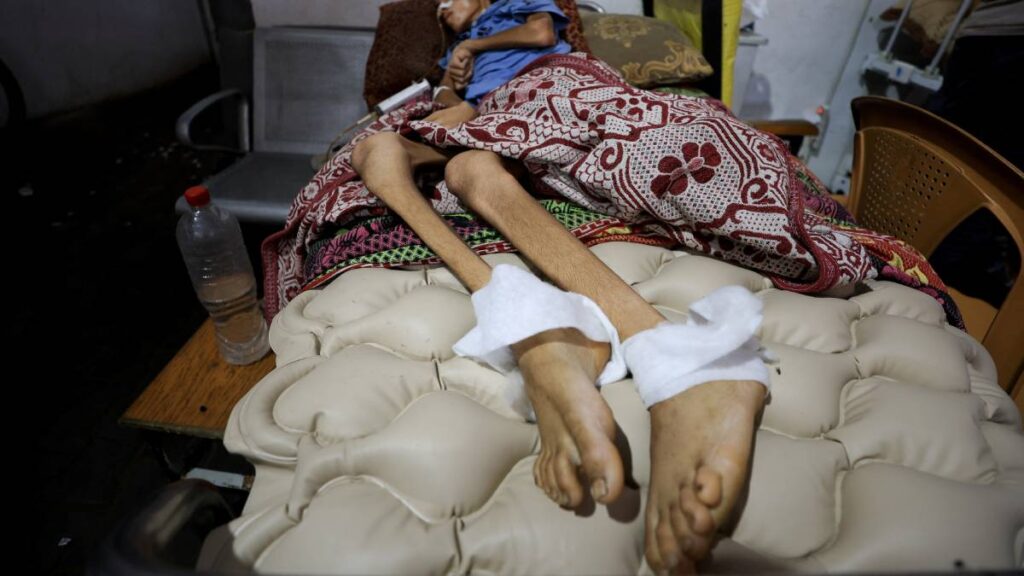 Gaza se muere de hambre