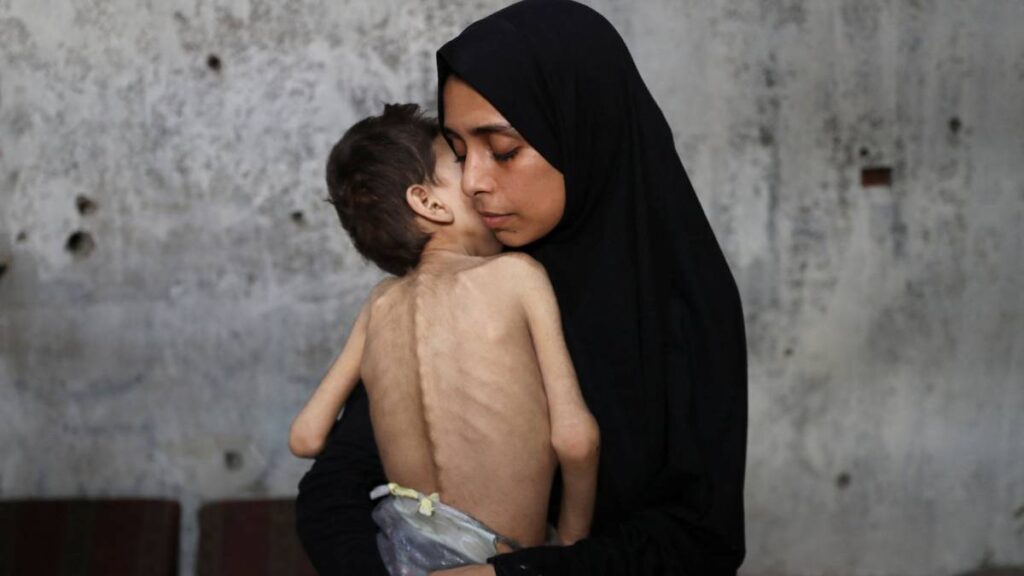 Hambruna en Gaza
