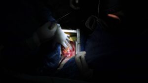 Murieron más de 818 mil personas en 2024; corazón, diabetes y cáncer principales causas