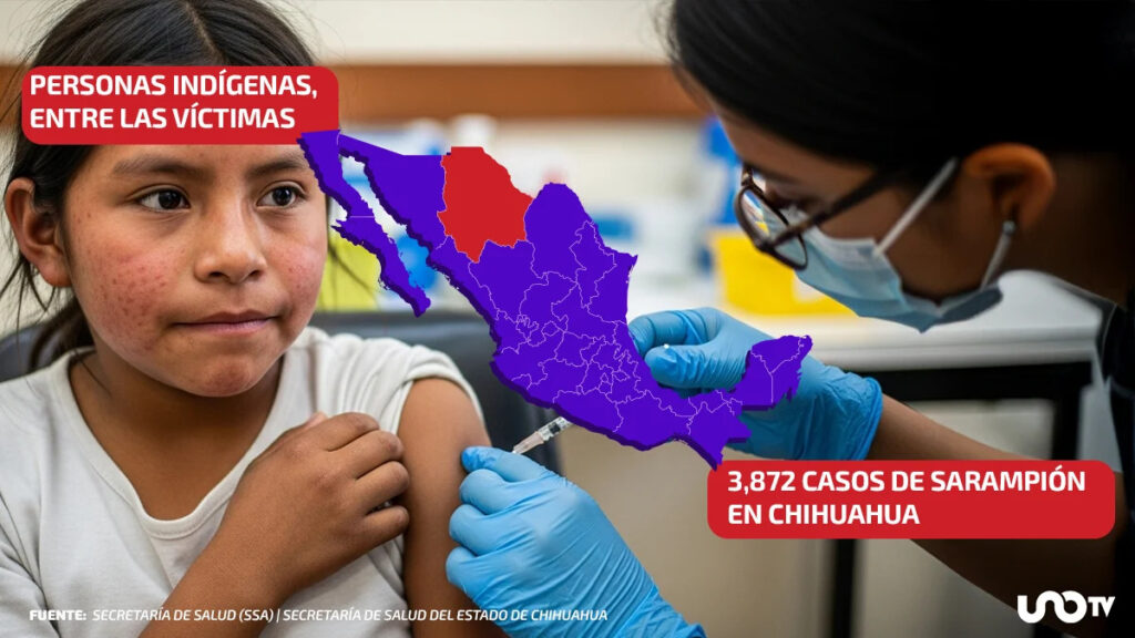 ¡Alertan por el brote de sarampión en Chihuahua!