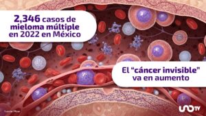 Desabastos y medicamentos falsos, los problemas para tratar el mieloma múltiple en México