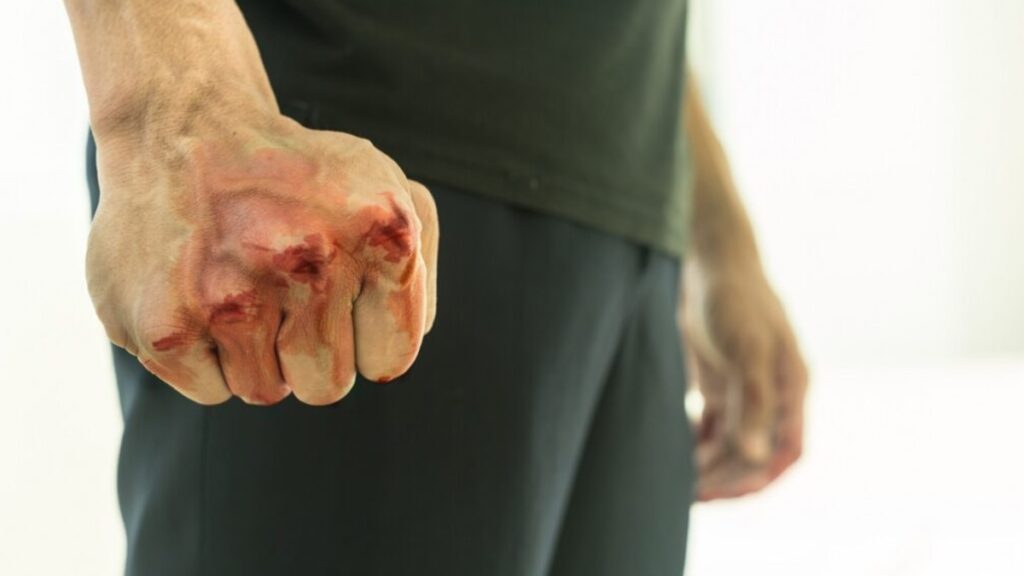 Por infraccionarlo: automovilista golpea a policía en Calpulalpan