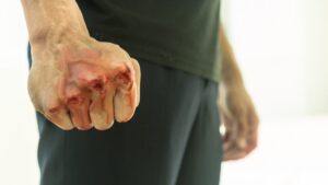 Por infraccionarlo, automovilista golpea a policía en Calpulalpan