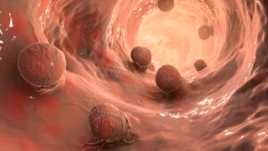 Pólipos en el colón: ¿qué es el tipo de cáncer que tuvo Regina Murguía?