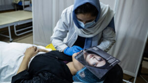 Botox y trasplantes capilares: cirugías estéticas están de moda en Afganistán