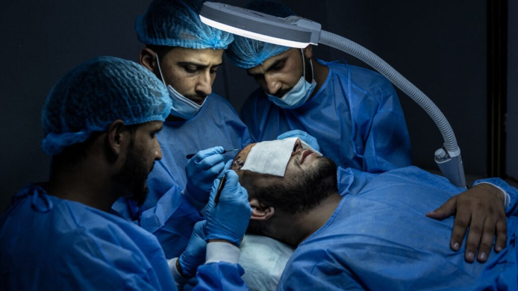 trasplantes capilares para hombres