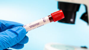 Crecen casos de enfermedad de Chagas en EE.UU. y piden considerarla como afección endémica