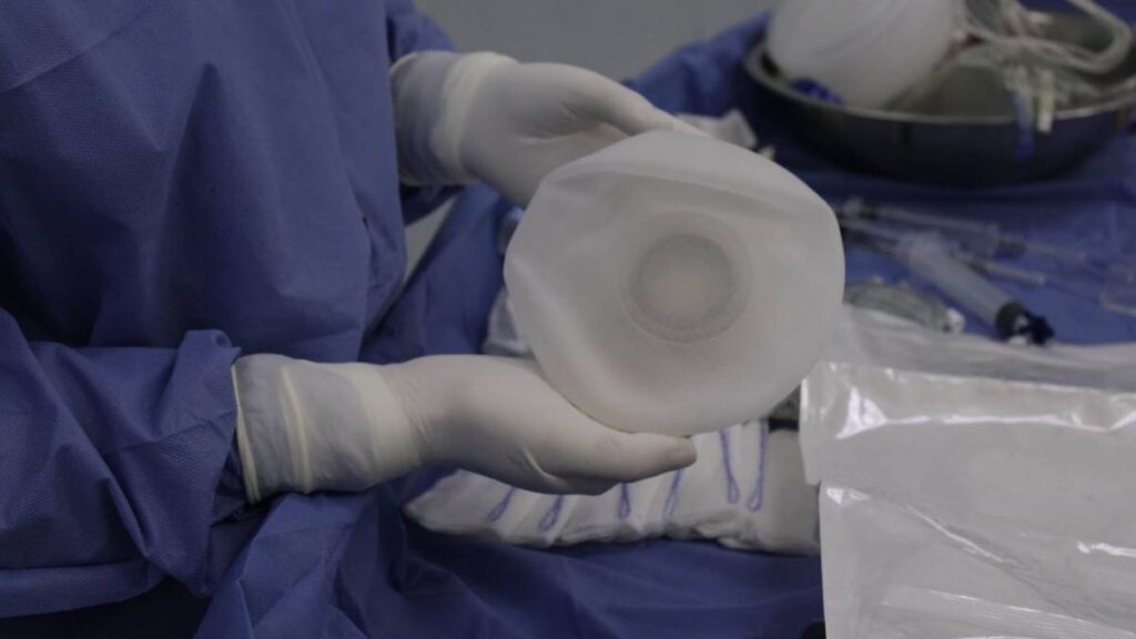 Médico que operó a Paloma Nicole es investigado.