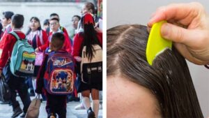 Regreso a clases: pediatra alerta sobre riesgos de contagios de enfermedades y piojos