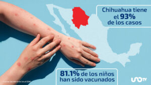 Confirman 4 mil 353 casos y 17 muertes por sarampión en México: advierten por brote de Chihuahua