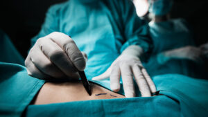 Caso Paloma Nicole, no hay límite de edad para las cirugías estéticas en México: “Cada paciente es único”